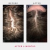 irestore-pro-uk-europe-laser-hair-growth-system-7