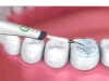 Tandrengöring 5 i 1 tandsten, plack, ultrasonisk