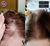 watermans-hair-growth-vital-set-schampo-balsam-conditioner-vitamin-danmark-denmark-4