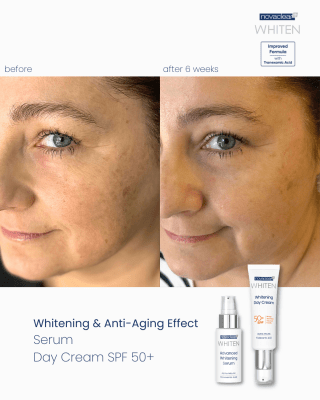 Whitening Day Cream SPF50+