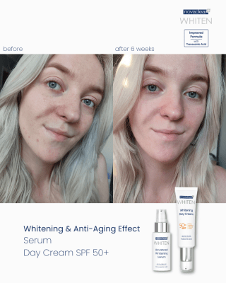 Whitening Facial Foam