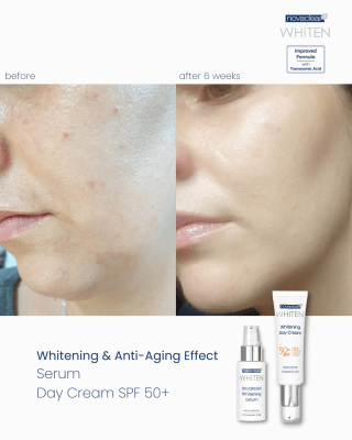 Whitening Day Cream SPF50+