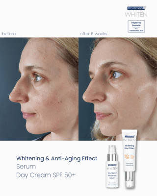 Whitening Facial Foam