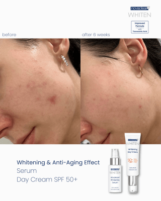 Whitening Serum Advanced