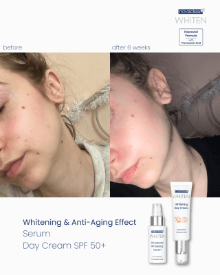 Whitening Day Cream SPF50+