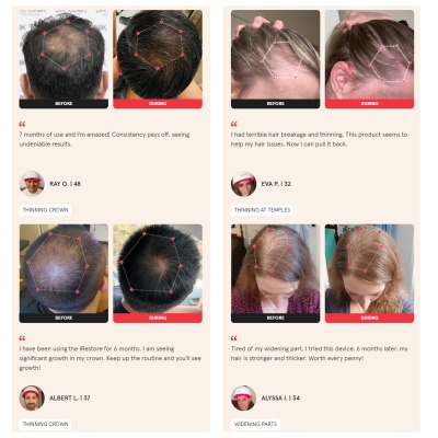 Laser Hair Growth System ELITE