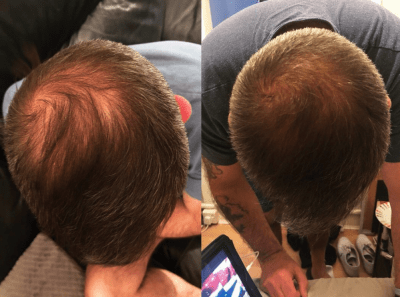 watermans-shampoo-schampo-grow-me-hair-growth-danmark-denmark-suomi-norge-3